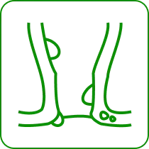 piles